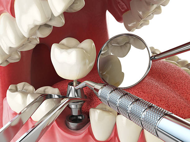 Best Emergency Dental Care for Broken or Chipped Teeth in West Long Branch, NJ
